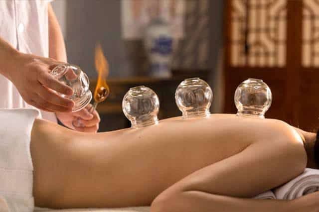 Traditional fire cupping therapy