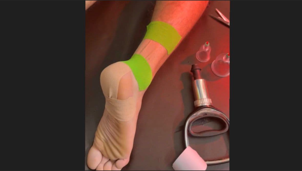 Kinesiology taping for a sports injury